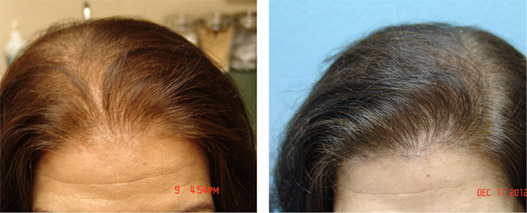 Before and after