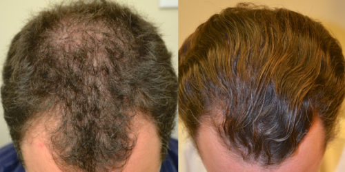 Before and after