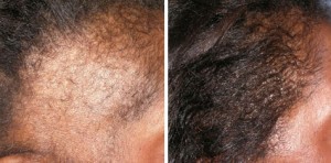 Before and after