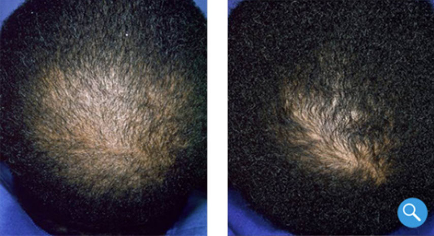 Before and after