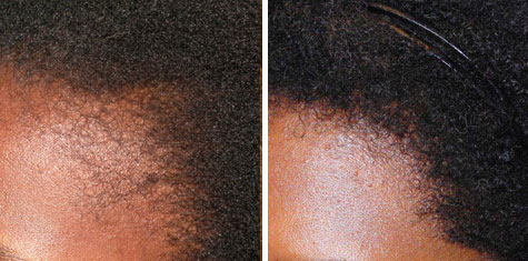 Before and after