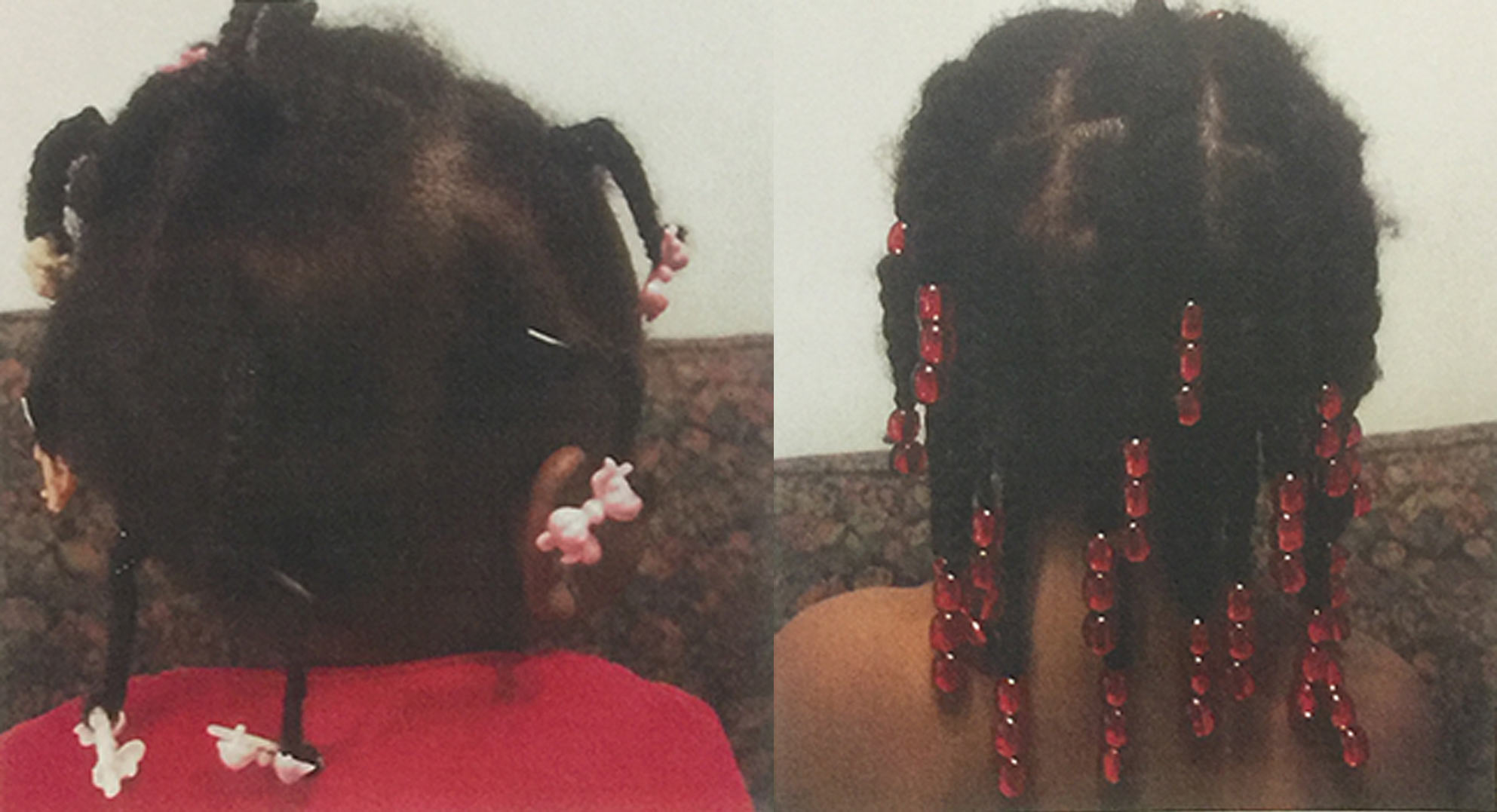 Before and after
