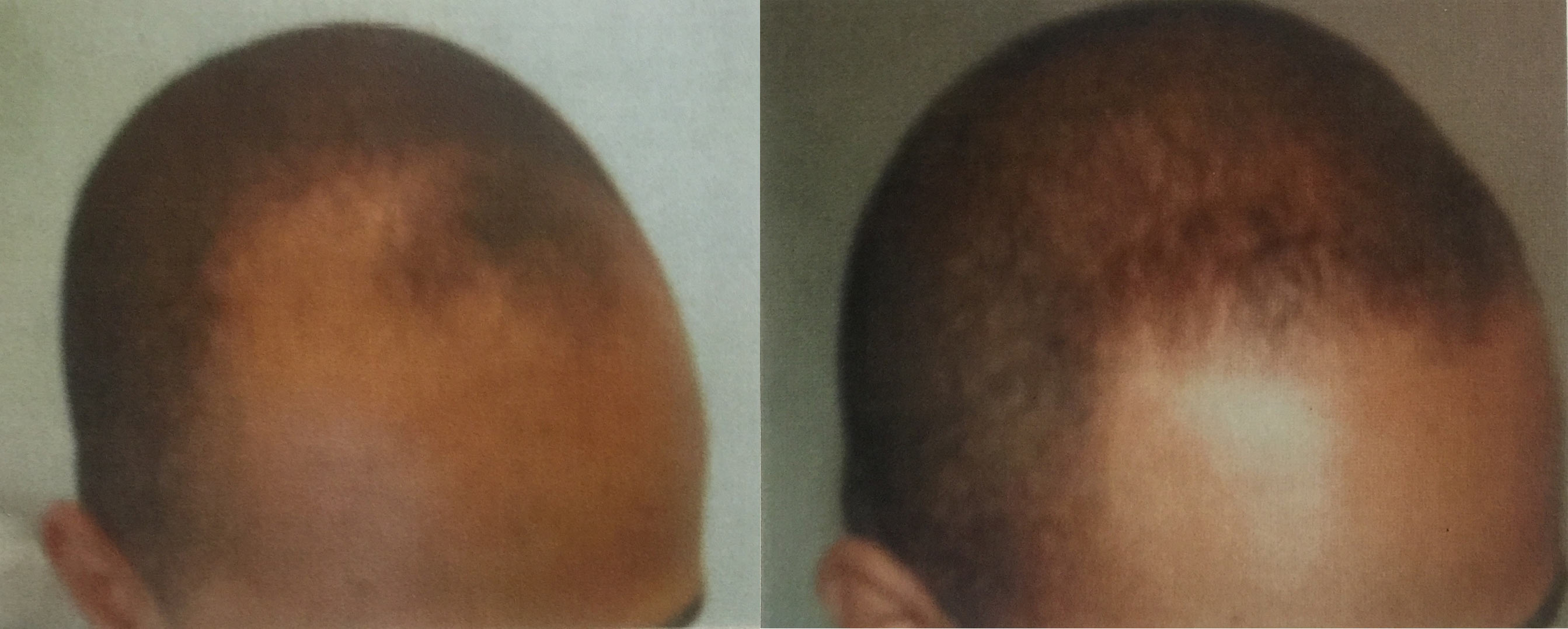 Before and after