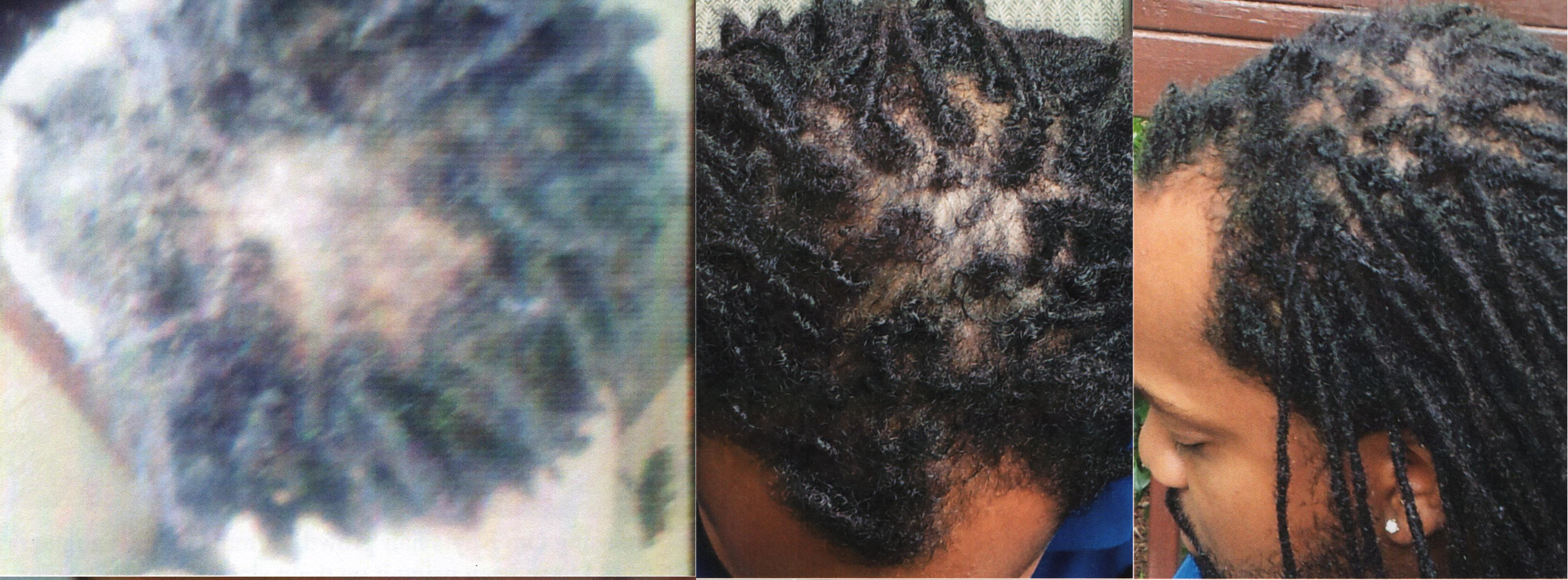 Before and after