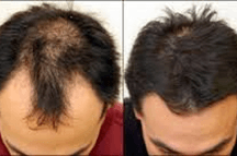 Before and after