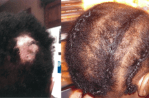 Before and after