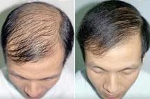 Before and after