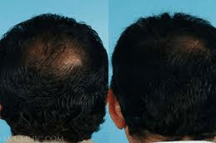 Before and after