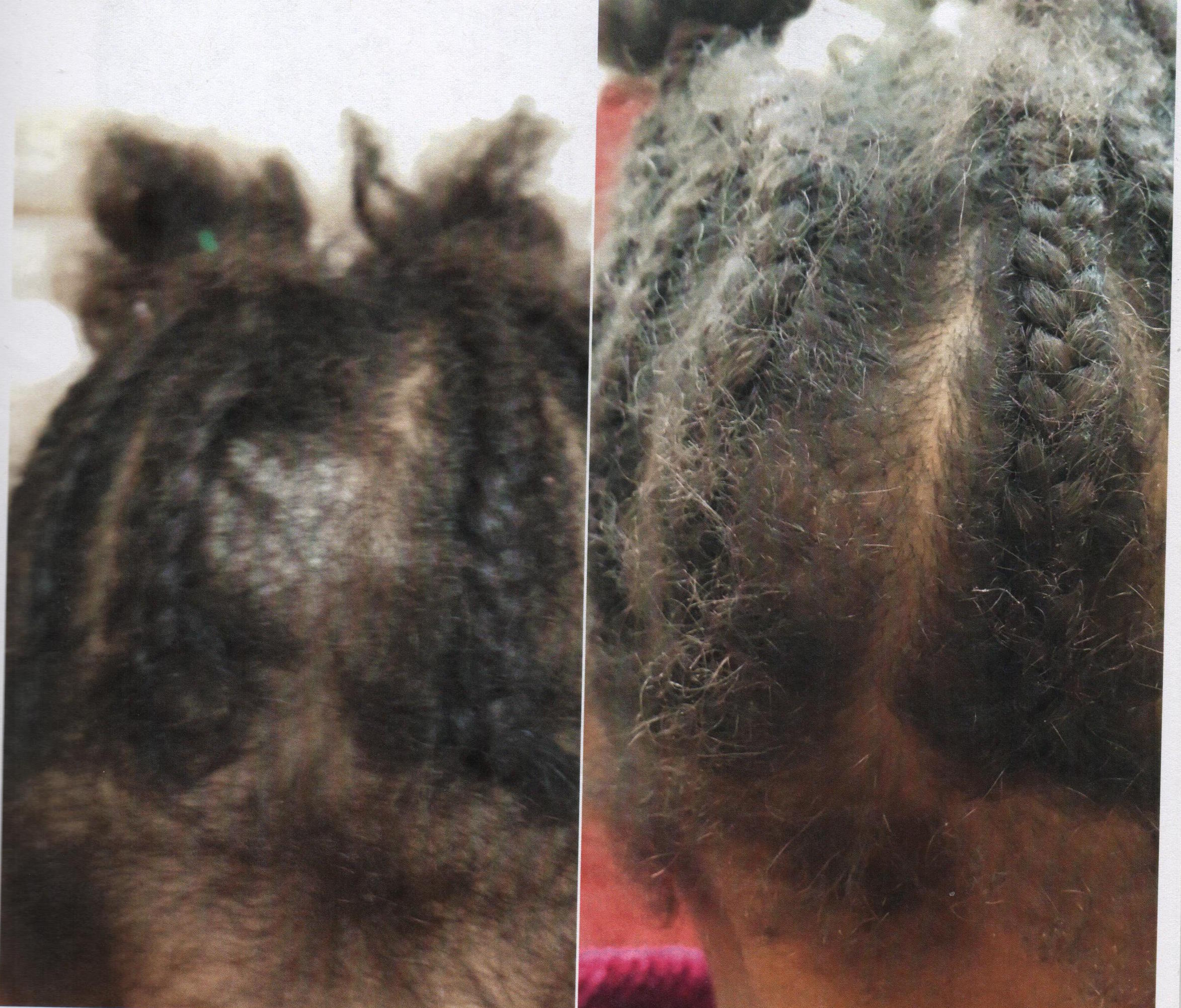 Before and after